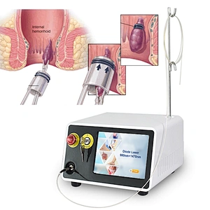 980nm 1470nm Hemorrhoid Laser Surgery Diode Laser Treatment Proctology Hemorrhoid