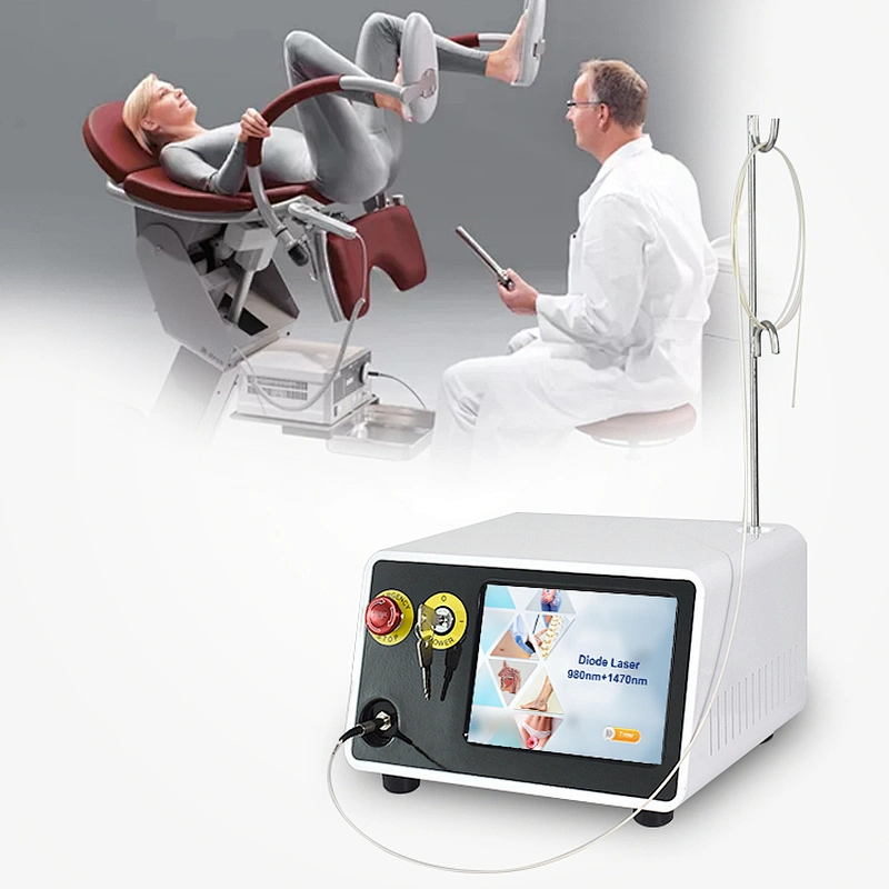 Hot Sale Portable 980nm 1470nm Hemorrhoid Diode Laser Excision Device for Proctology Hemorrhoid Piles Treatment