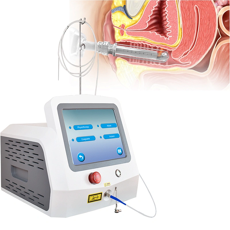 980nm1470nm Diode Laser Vaginal Tightening Gynecology Tightener Machine Vagina Eliminate Vaginal Odor and Itching Vagina Massage