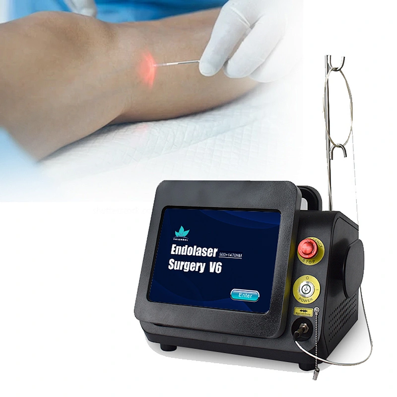 Spider Vein Telangiectasis Varicose Lesion Removal Laser Machine 980nm 1470nm Wavelength