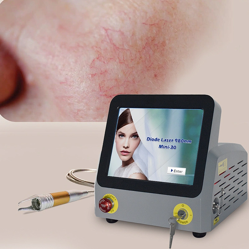 Newest 980nm Diode Laser Vascular Remove 980nm 30w Laser Machine for Spider Treatment Beauty Treatment
