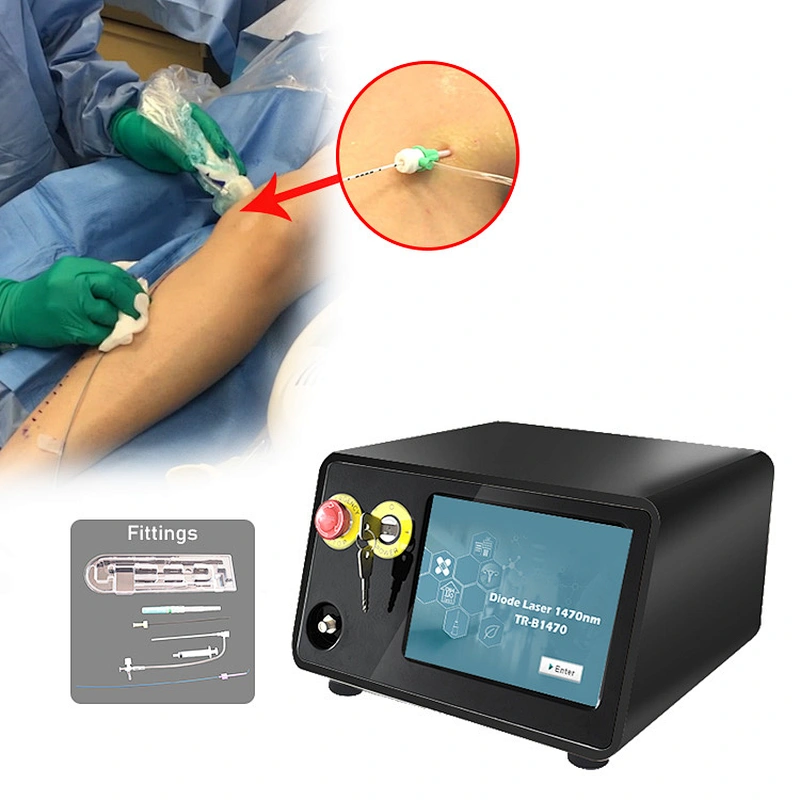 Upgraded 1470nm 17W EVLT EndoVenous Laser Therapy EVLA Varicose Vein Ablation Laser Machine