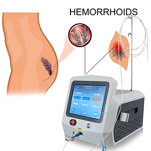 980nm1470nm Hemorrhoids Laser Proctology Surgery Germany Laser Emitter Fistula Laser Device