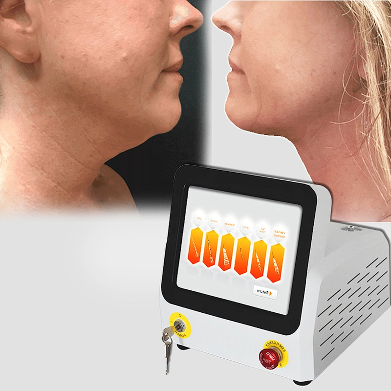 New Arrival Portable Mini Invasive Endo Laser Lipolysis Machine 1470nm 1060nm 980nm Fiber Liposuction