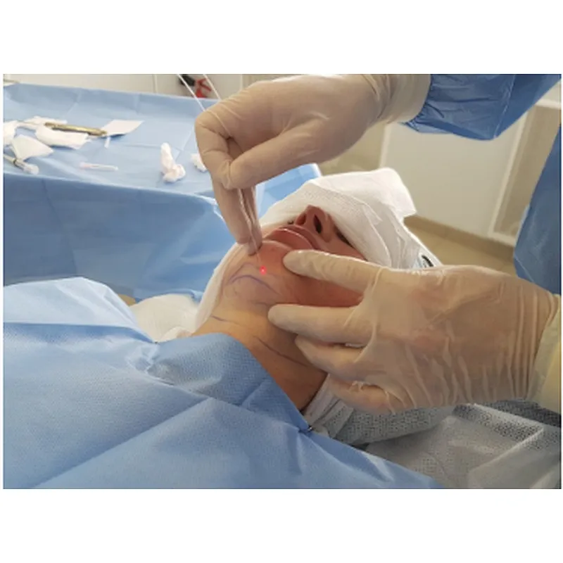 980nm Laser Gynecomastia Lipolysis  Facelift Plasticsurgery