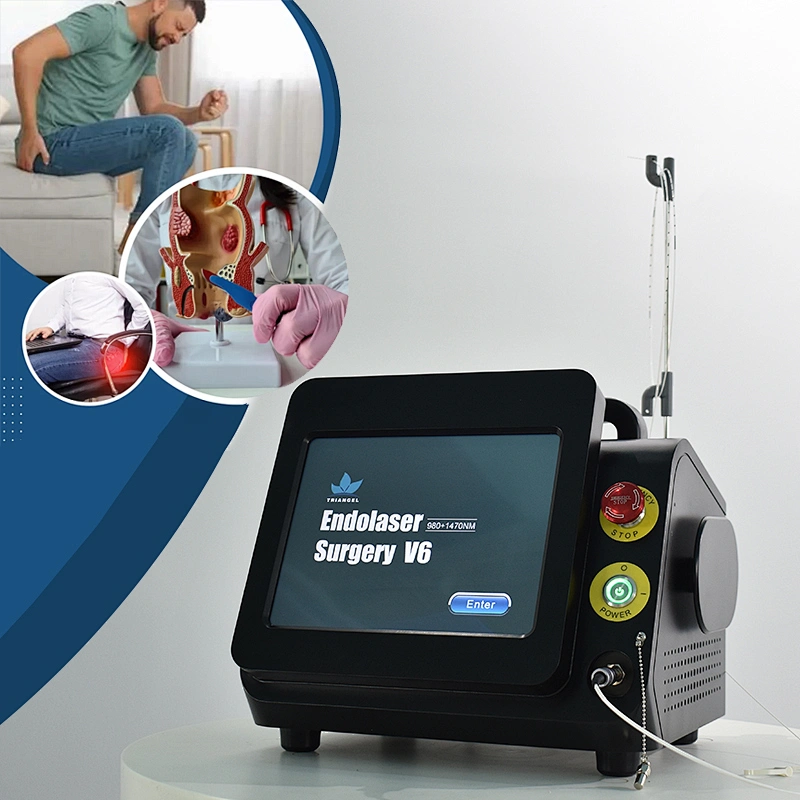 980nm1470nm Proctology Surgical Treatment Machine High Power Removal Fistula Hemorrhoids Pilonidal Sinus