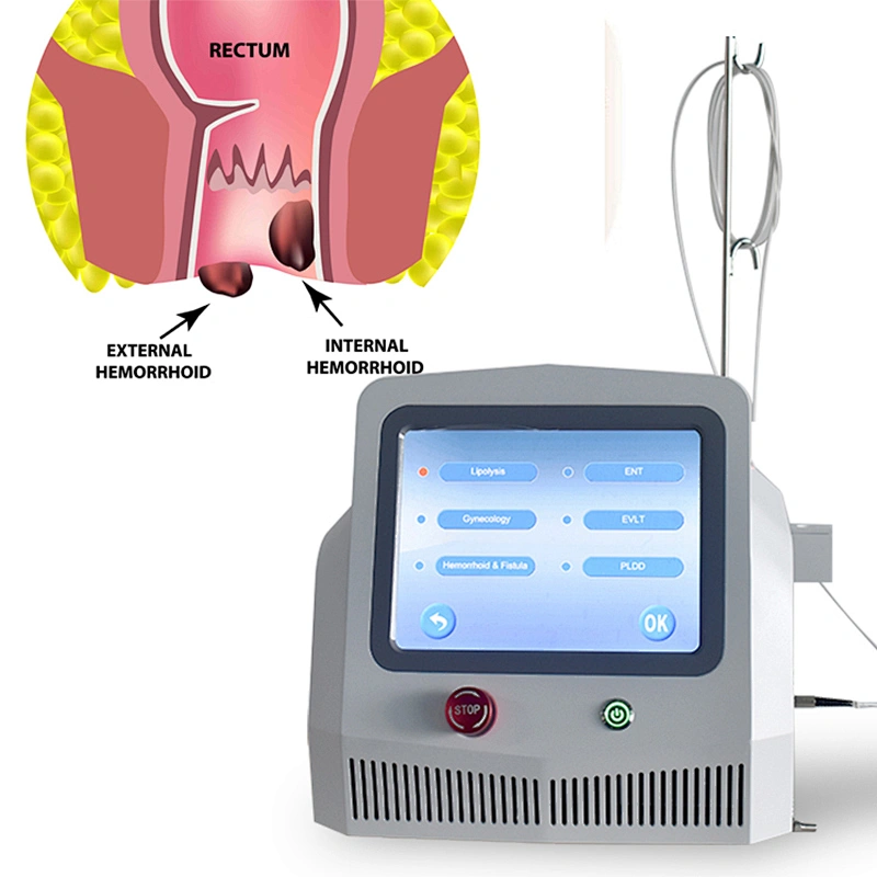 Dual Wave Diode Laser Portable Equipment 980 1470 Nm For Hemorrhoid Remove Proctological Trentment Piles
