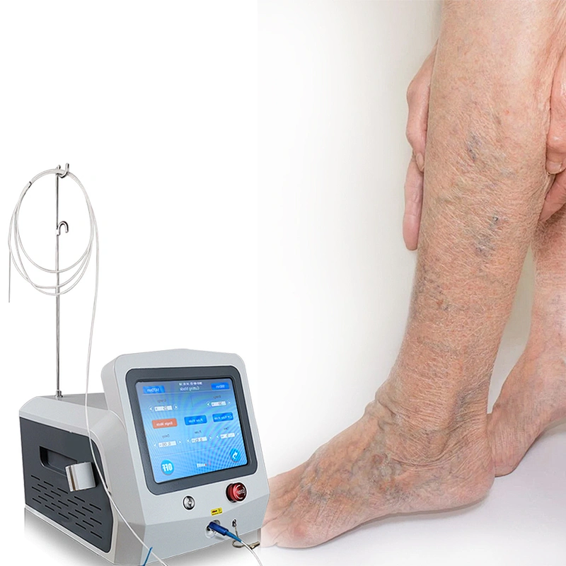 980 nm 1470nm Varices EVLT EVLA Spider Endovenous Therapy Diode Laser Ablation Machine for Varicose Vein Removal Fiber