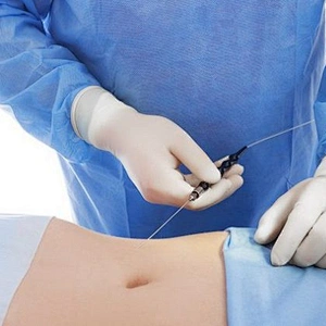 Professional Vascular Laser Physical Therapy Equipments Nail Fungus Treatment Liposuction Machine Vaser Diode Laser