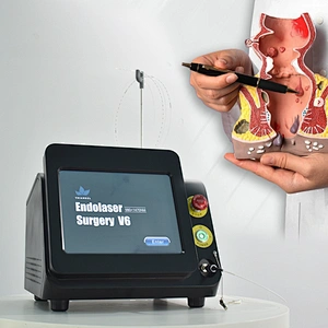 Anal Fistula and Hemorrhoids Fiber Laser Equipment Anal Piles Fistula Fissure and Pilonidal Sinus Diode 980nm 1470nm