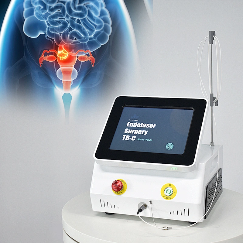 Vaginal Tightening Laser Machine Rejuvenation For Vaginal Dryness and SUI For Women Gynecology Laser