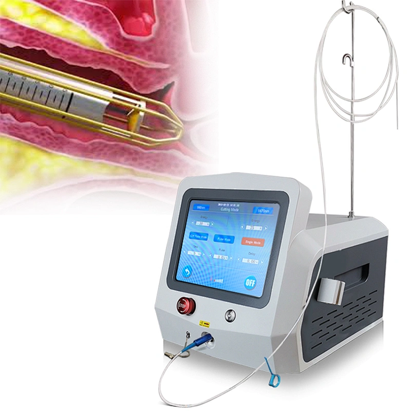 2025 Hot Sale Minimally Invasive 980nm1470nm Diode Laser Vaginal Tightening Laser  Therapy Instruments