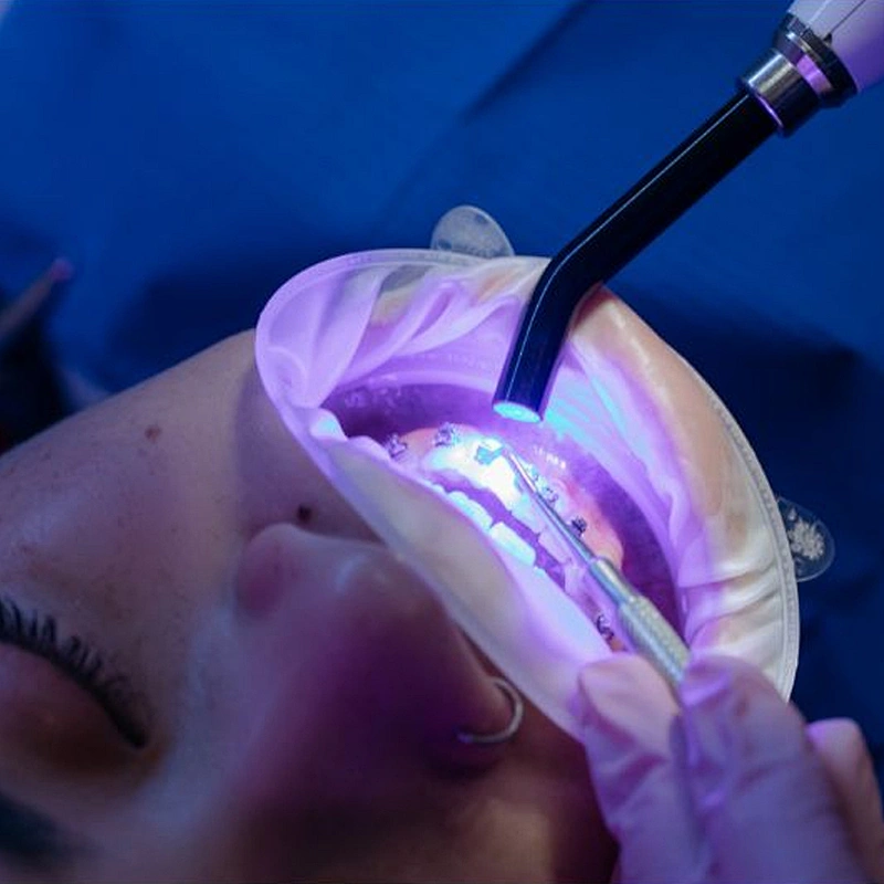 Dental Diode Laser 980nm Teeth Whitening Soft Tissue Cutting Dental  Machine