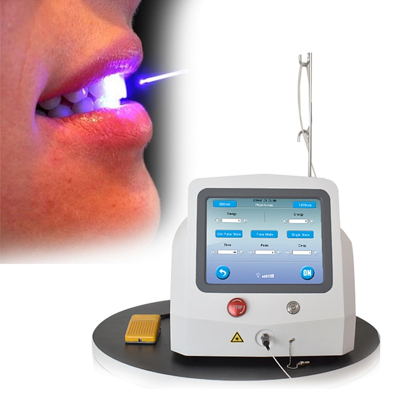 2025 Newest Portable Diode Laser Teeth Whitening Soft Tissue Cutting Dental 980nm1470nm Dual Wavelength Device