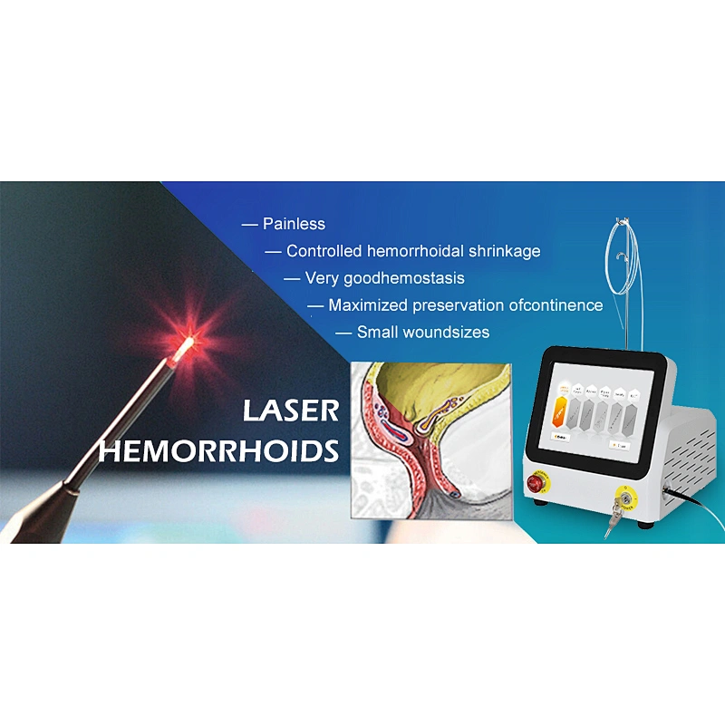 2024 Hot Seller 980nm 60w Diode Laser for Hemorrhoids Laser Fistula Treatment