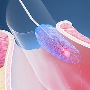 High Quality Chinese Manufacturer Anorectal Laser 980nm 1470nm Hemorrhoid Intestinal Hair Sinusiostomy Machine