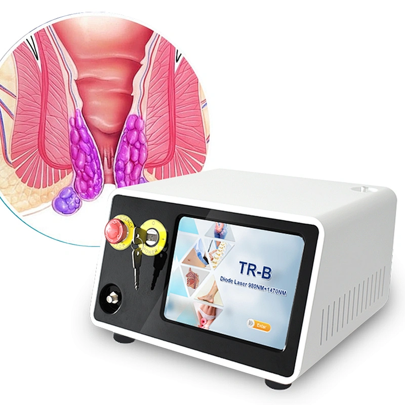 2025 Best Sell Proctology Hemorrhoids  Diode Laser Surgery 980nm1470nm Laser Treatment Remove Anal Fistula Hemorrhoids