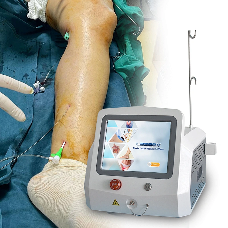 Radial Laser Fiber EVLT Varicose Vein Removal 1470nm 1940nm Laser Wavelenth Machine