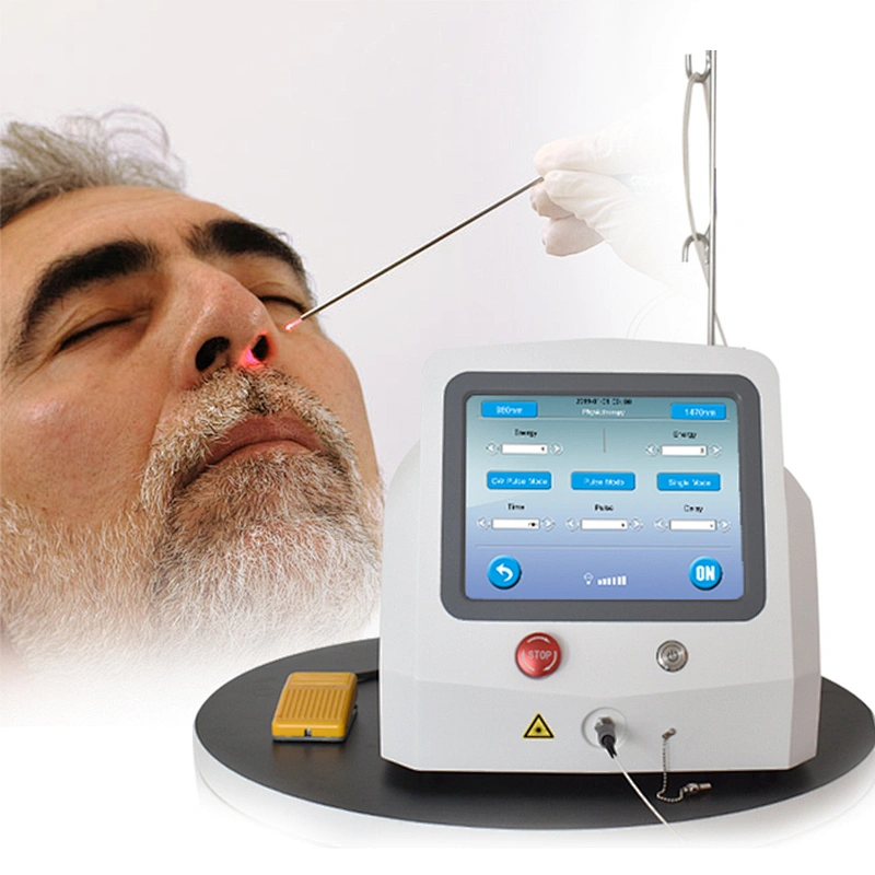 Non Invasive Ear Nose Throat Surgery  Laser ENT Surgical Diode Laser Treatment Medical Instruments