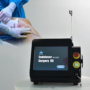 Diode Laser Removal Legs Varicose Veins 980nm 1470nm EVLT Endovenous Varicose Veins Treatment Machine