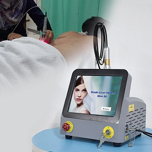 TRIANGEL New Sale Class 4 Diode Laser Machine 980nm Professional Laser Physiotherapy Shoulder Joint Pain