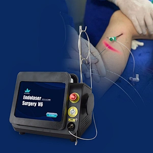 High Effectiveness 980nm 1470nm Diode Laser Varicose Veins Machine