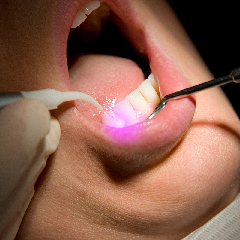Dual Wave 810nm 980nm 1470nm Diode Laser Therapy Dental Soft Tissue Laser Machine