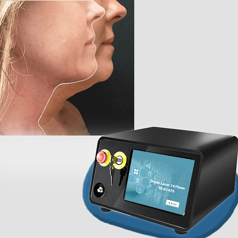 Endo Laser Lift Diode Laser 980nm 1470 Lipolysis Liposuction Weight Loss Cannula Fat Surgery Slimming  Machine