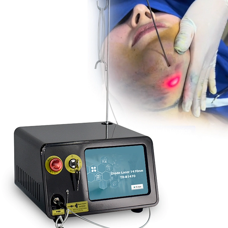 1470nm Endolaser Face Lift Liposuction Machine Diode Laser Fat Removal Remove a Double Chin Lipolysis Laser Equipment