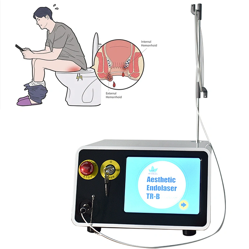 Hot Selling 980nm 1470nm Hemorrhoids Treatment Laser Diode Machine