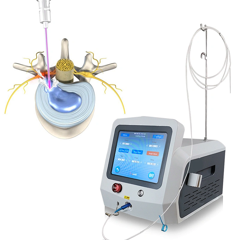 Effectively 47w Laseev Orthopedist Use Curing Slipped Discs PLDD