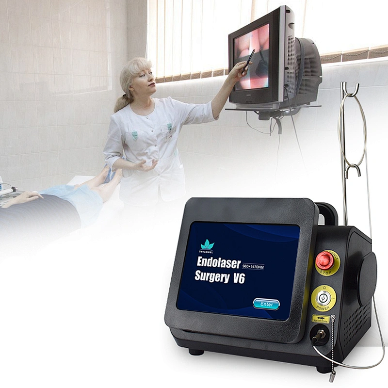 980nm 1470nm Diode Laser for Hemorrhoids Anal Fistula Surgery Effectively Painless Doctor Use Advanced Tech