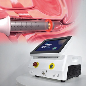 Vaginal Tightening Laser Machine Rejuvenation For Vaginal Dryness and SUI For Women Gynecology Laser