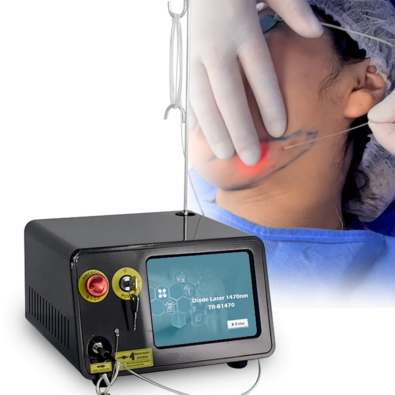 Best Price 1470nm  Fiber Lift Laser Lipolysis  No Pain No Bleeding Face Lifting Skin Tightening