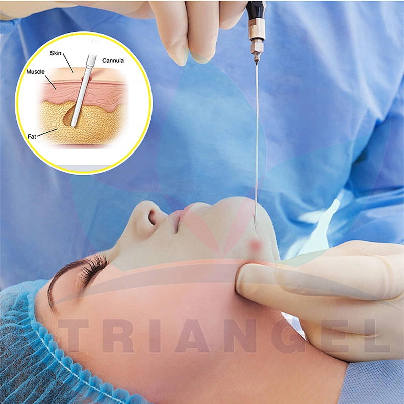 Lipolysis Plastic Surgery Fiber Laser Facial Lifting Laser Endolaser Diodo 1470nm 980nm