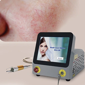 2024 New Deslgn Class IV 980nm Dlode Laser Machine for Spider Vein Vascular Removal