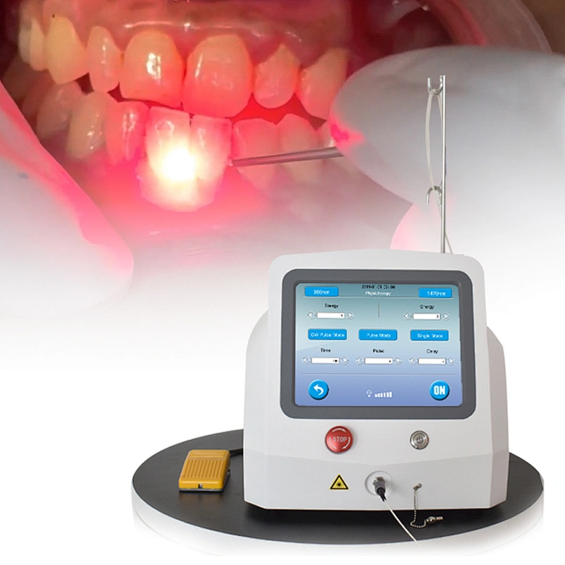 2025 Newest Portable Diode Laser Teeth Whitening Soft Tissue Cutting Dental 980nm1470nm Dual Wavelength Device