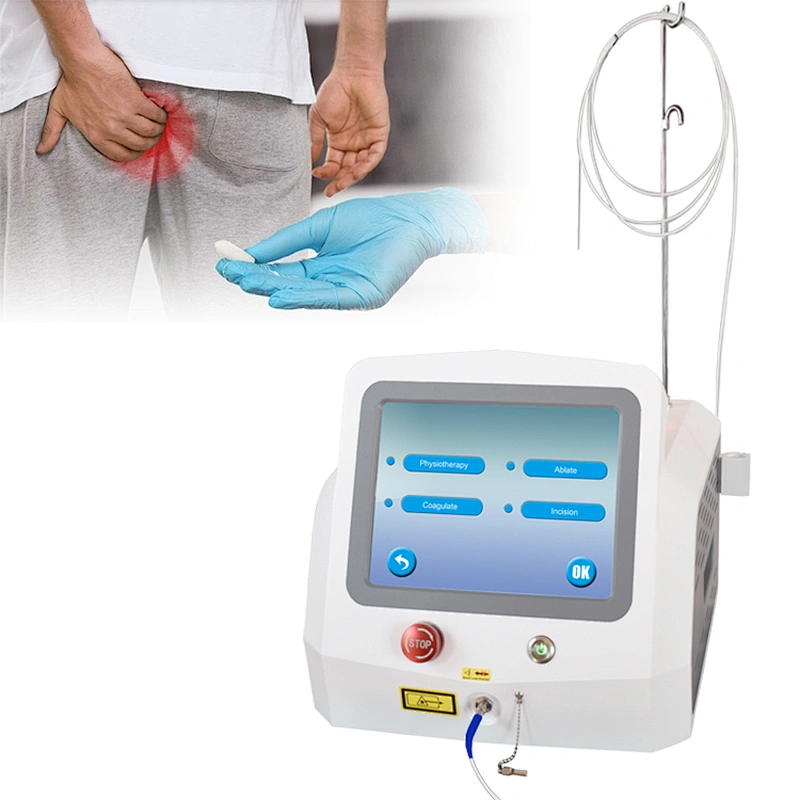 Factory Price Hot Sale Proctology Laser Surgery Machine Diode Laser 980nm1470nm Treatment Hemorrhoids(piles)