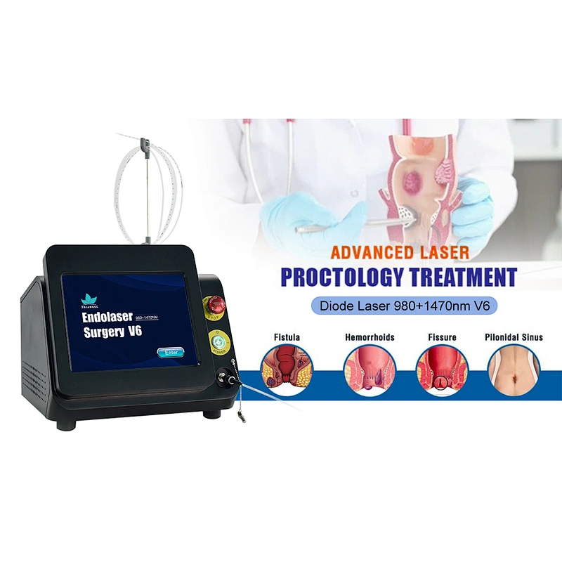 1470 Diode Laser Spider Proctology Hemorrhoids 980 Hemorrhoid Surgic Laser Instrument