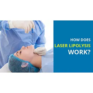 2023 Laser Face Lift Machine Plastic Surgery  Fiber Optic Diode Laser Fat Reduce Vaser 1470 Machine