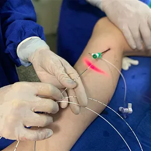 EVLT EVLA  Diode Laser 1470nm Phlebology Endovenous Laser Varicose Vein Surgery Laser