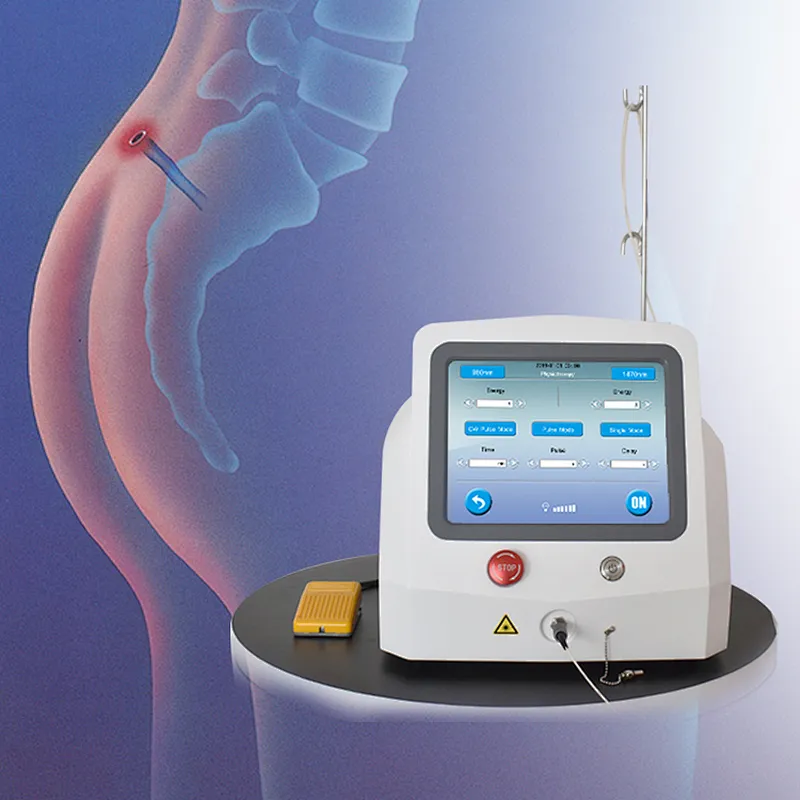 Laser 980nm 1470nm for Hemorrhoids Polyps and Anal Fissures Hemostasis Cutting Coagulation Laser
