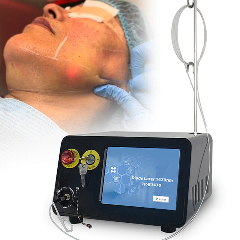 1470nm Endolaser Face Lift Liposuction Machine Diode Laser Fat Removal Remove a Double Chin Lipolysis Laser Equipment