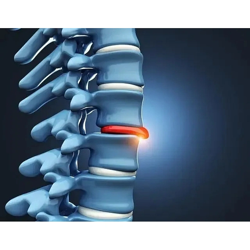 Portable 980nm 1470nm Diode Laser for Surgical PLDD-Percutaneous Laser Disc Decompression Kyphoplasty Treatment