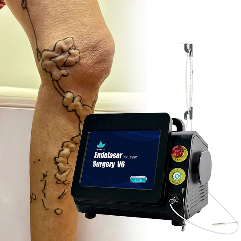 980nm1470nm Leg Varicose Vein  Laser EVLT EVLA  Endovenous Vein Surgery Laser Machine