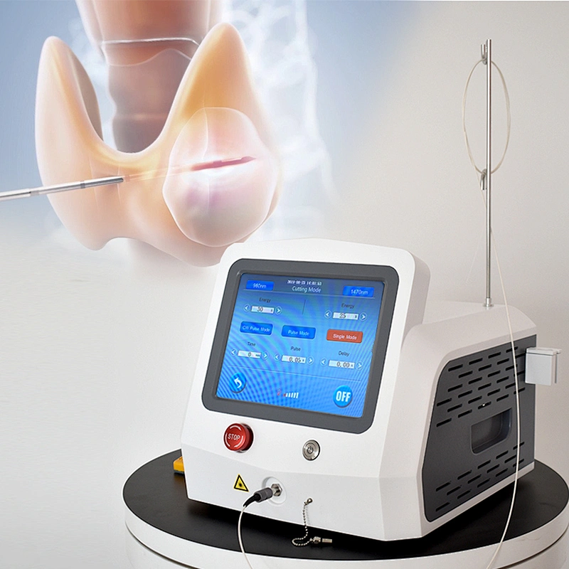 PLDD Laser 1470nm Treatment Surgery Fiber Percutaneous Laser Disc Decompression