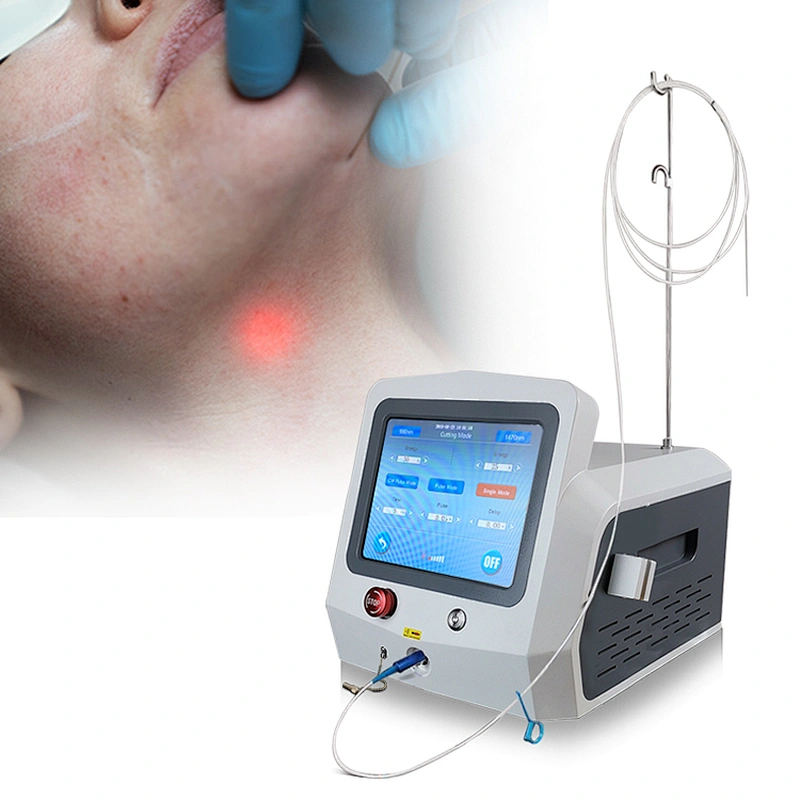 Hot Sell Surgery Dual-Wavelength Laser 980nm+1470nm Skin Lift Liposuction Fat Ablation Laser Machine Lipolysis