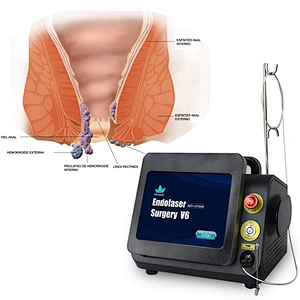 2024 Best Sell Diode Laser 980 1470 nm for Hemorrhoid Laser Diodo Hemorroides