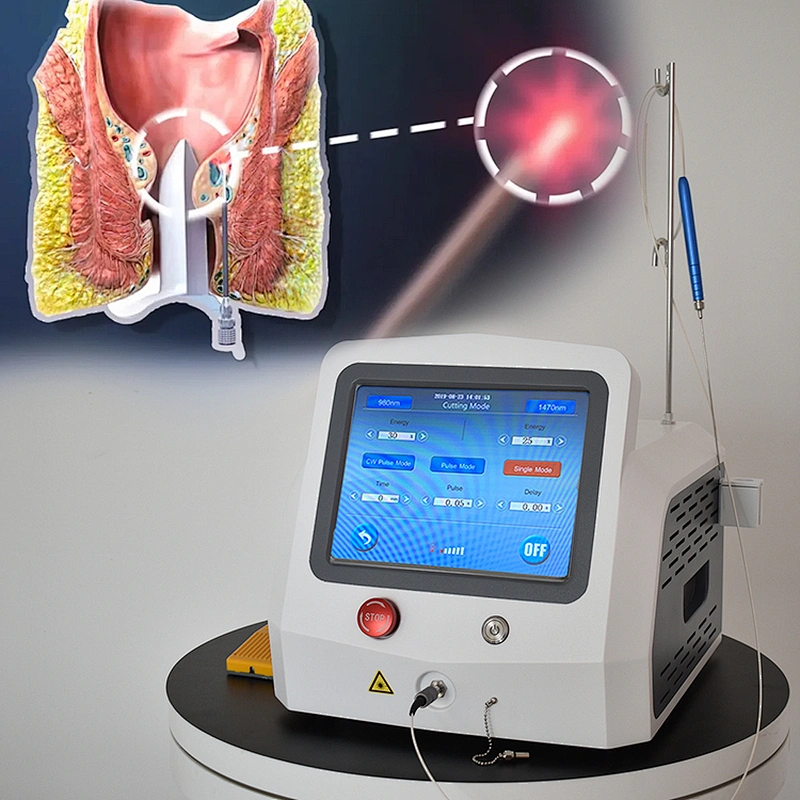 Newest 980nm 1470nm  Proctology Surgical Laser for Hemorrhoid Treatment Medical Equipment