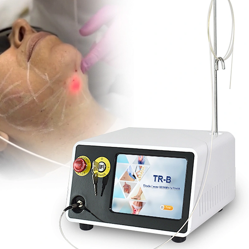 Factory Supply  Liposuction Lipolysis Fat Reduction Skin Rejuvenation Face Lifting Laser 1470nm